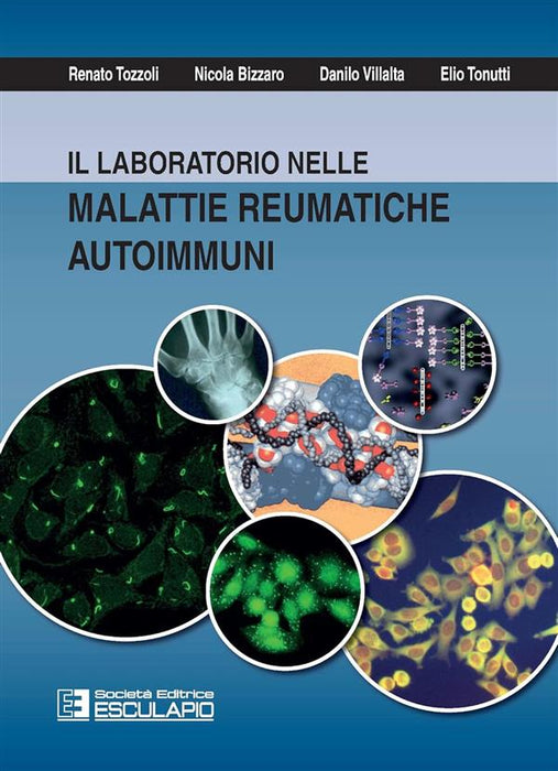 Il laboratorio nelle malattie reumatiche autoimmuni