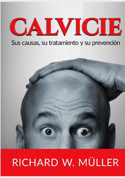 Calvicie
