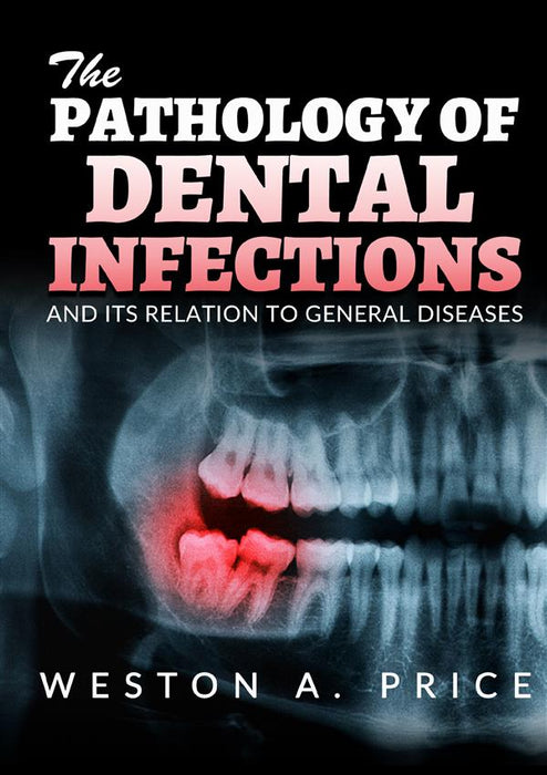 The Pathology of Dental infections