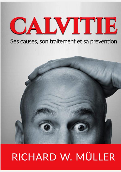 Calvitie